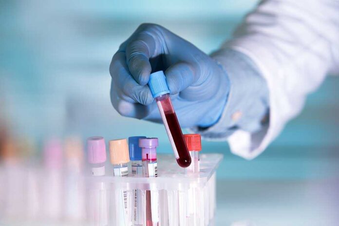 441264445 featured image Gloved hand holding a test tube with blood.