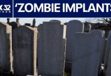 Beauticians Injecting Dead Body Derived Fat into Patients ‘Zombie filler’ uses cadaver tissue in cosmetic treatments | ChicagoLIVE