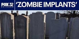 ‘Zombie filler’ uses cadaver tissue in cosmetic treatments | ChicagoLIVE